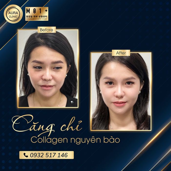 Hình ảnh 1 tại Aura Beauty Clinic - ABC