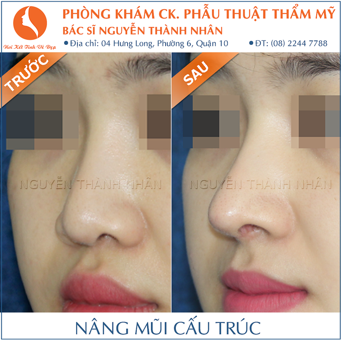 Hình ảnh 2 của Phòng khám chuyên khoa Phẫu Thuật Thẩm Mỹ TS. BS. Nguyễn Thành Nhân