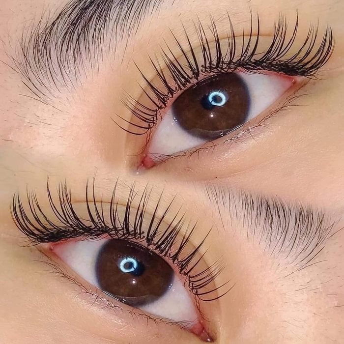 Nối Mi Lyn - Hình 2