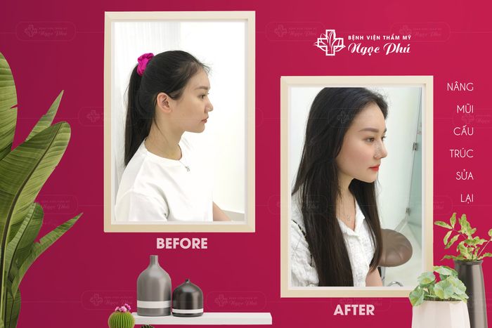 Bệnh viện thẩm mỹ Ngọc Phú - Hình ảnh 2