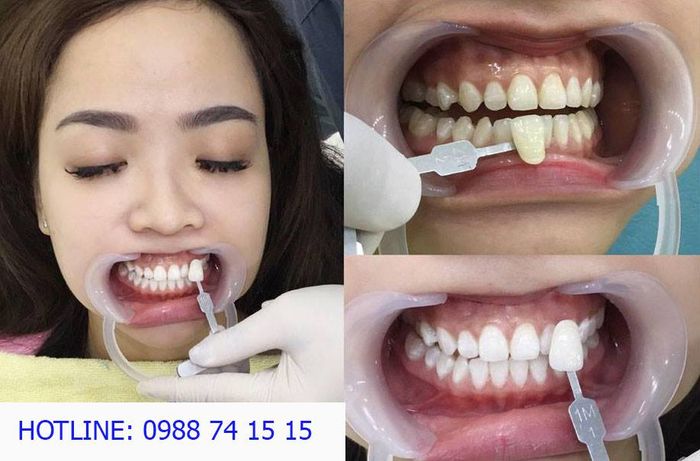 Nha khoa Thanh Bình hình ảnh 2