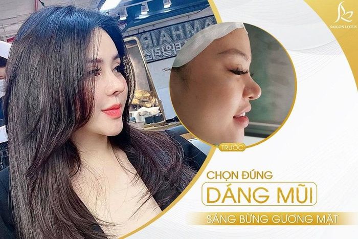 Hình ảnh 1 của Phòng Khám Thẩm Mỹ Saigon Lotus