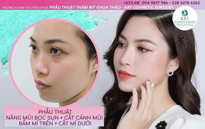Hình ảnh KAT Cosmetic Surgery 2