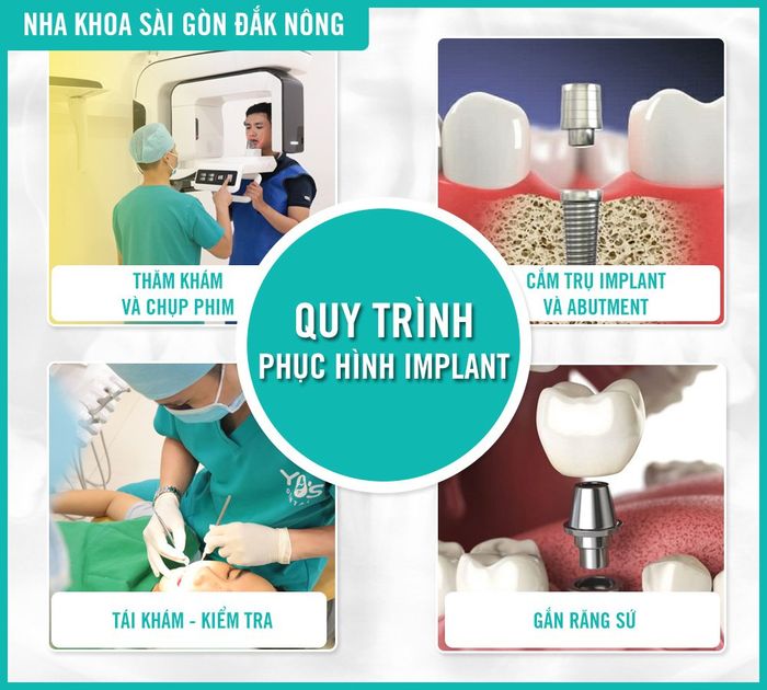 Nha khoa Sài Gòn 9 tại Đắk Nông - Hình ảnh 1