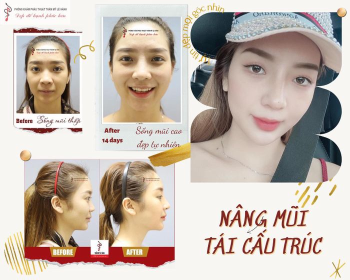 Hình ảnh Phòng khám Thẩm mỹ Lê Hành 2