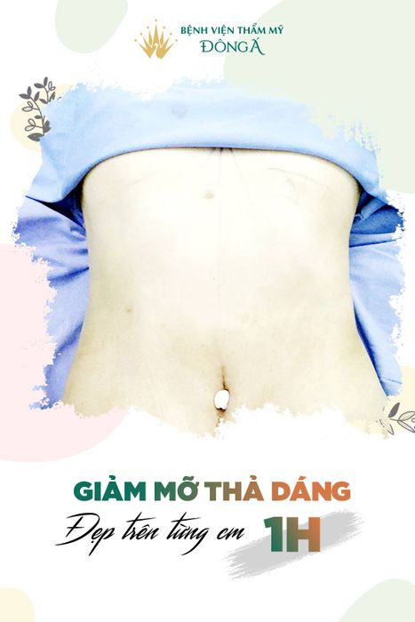 Thẩm Mỹ Viện Đông Á hình ảnh 2