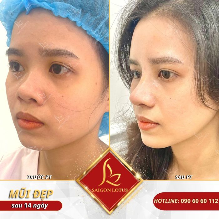 Hình ảnh 2 của Phòng Khám Thẩm Mỹ Saigon Lotus