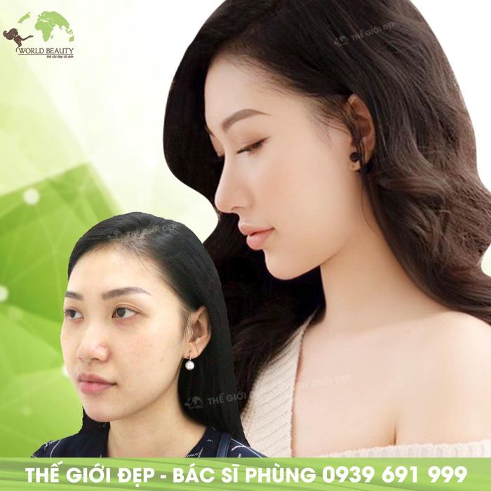 Hình ảnh 1 của Thẩm Mỹ Thế Giới Đẹp