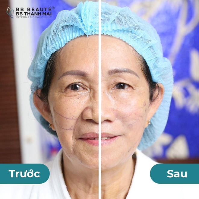 BB Beauté - BB Thanh Mai - Hình ảnh 1