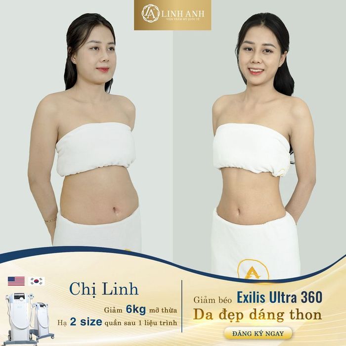 Hình ảnh Thẩm Mỹ Quốc Tế Linh Anh