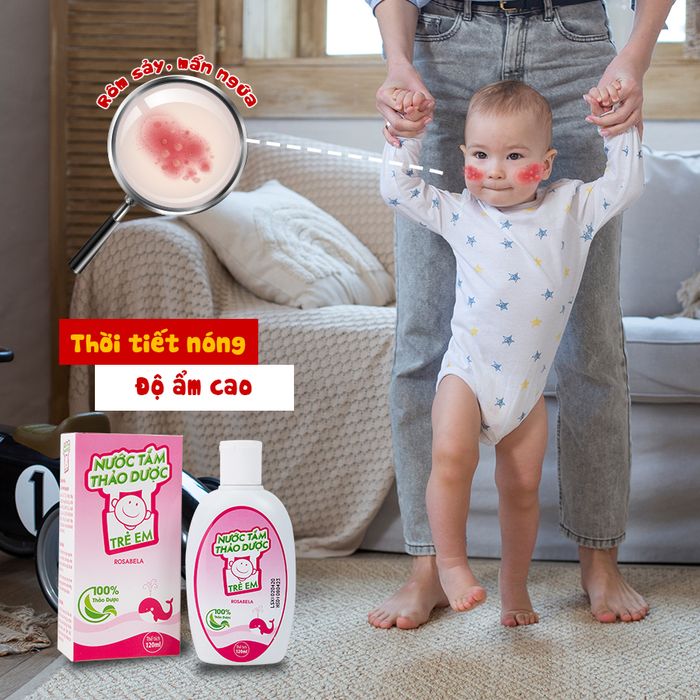 Nước Tắm Thảo Dược Cho Trẻ Em Rosabela - Ảnh 1