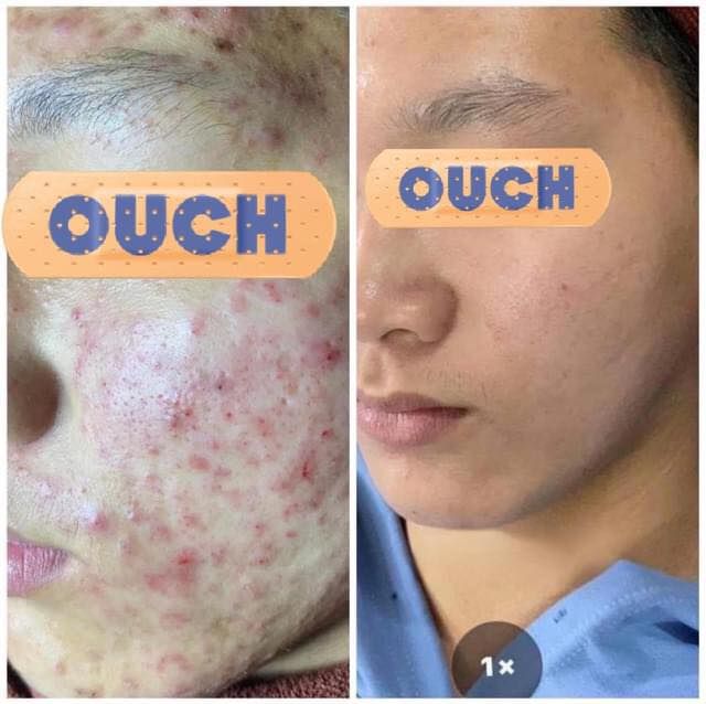  hình ảnh 2