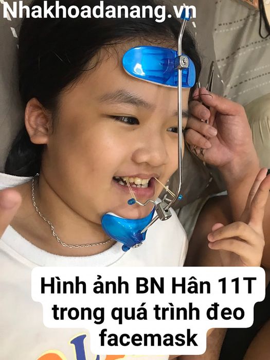 Hình ảnh thứ 3 của Nha Khoa Thẩm Mỹ Đà Nẵng