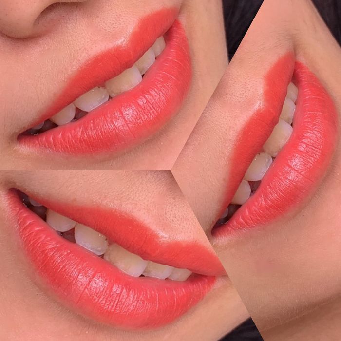 Spa Loan Beauty, ảnh 1