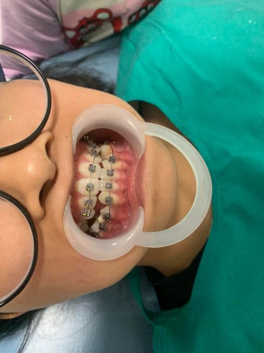 Nha Khoa Bác Sĩ Đức - Hình ảnh 2