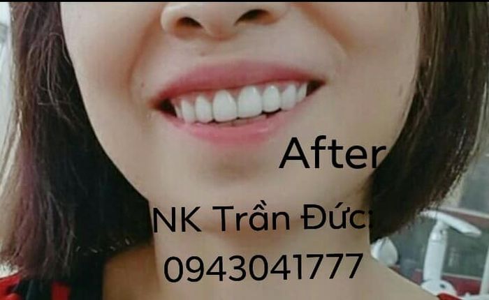 Hình ảnh Nha Khoa Trần Đức 2