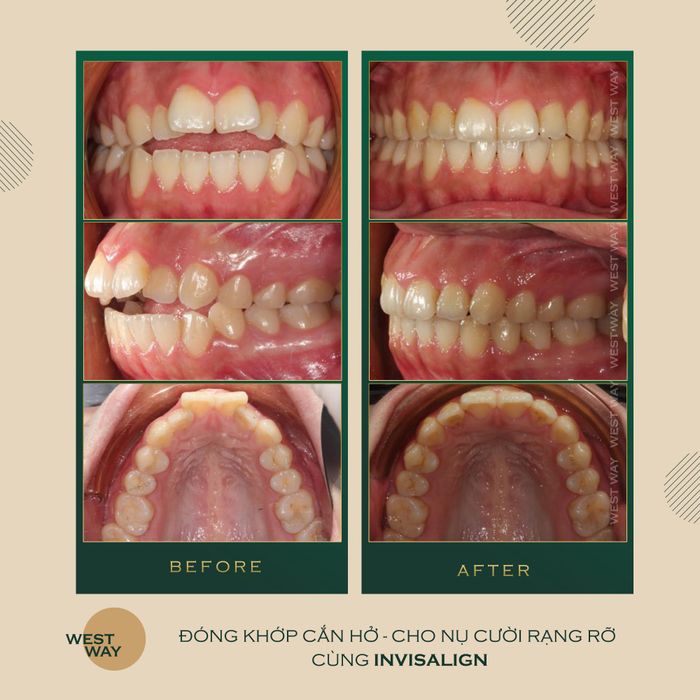 Westway - Niềng Răng Đẳng Cấp 5 Sao hình ảnh 1