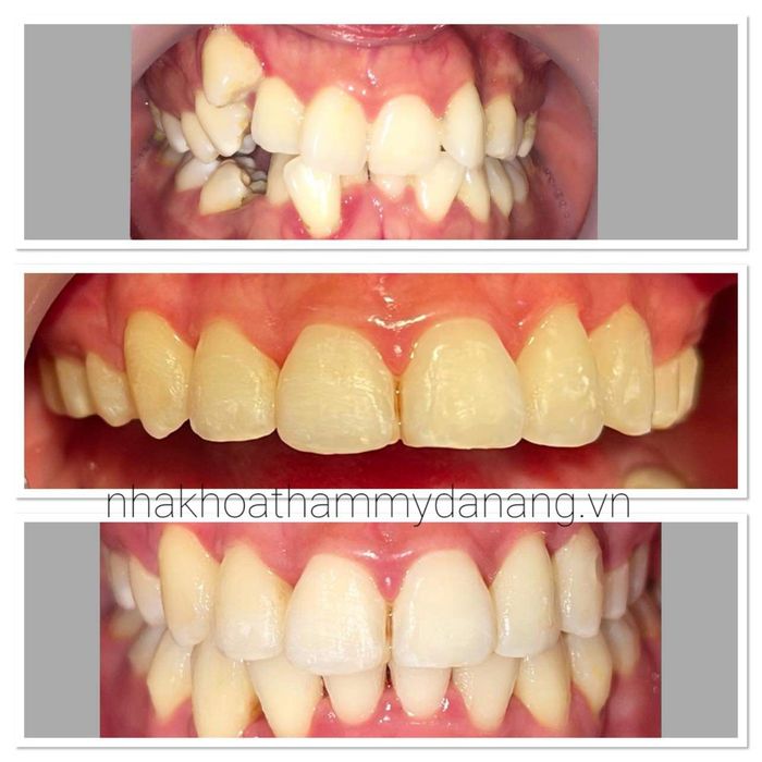 Hình ảnh thứ 2 của Nha Khoa Thẩm Mỹ Đà Nẵng
