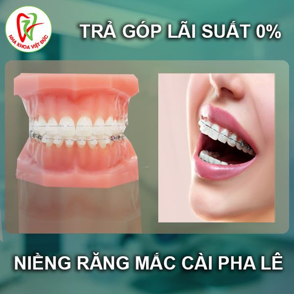 Nha Khoa Việt Đức hình 2