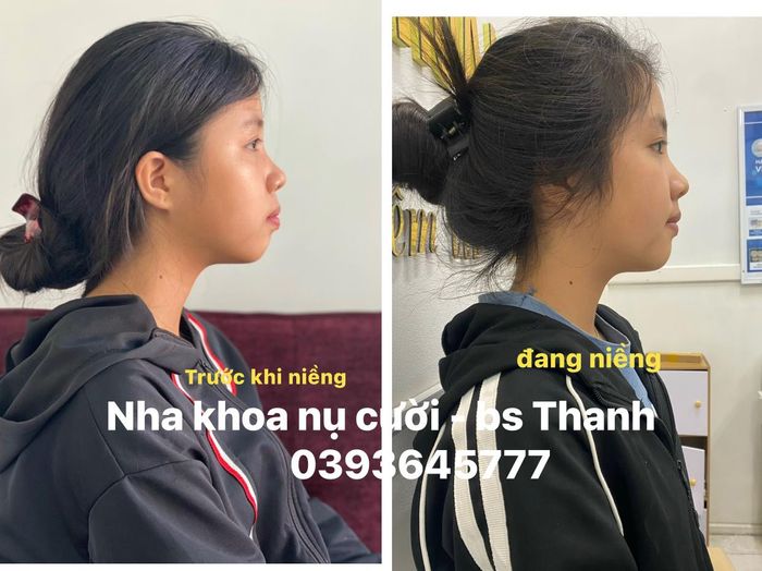 Nha khoa Nụ Cười - Bác sĩ Thanh, ảnh 2