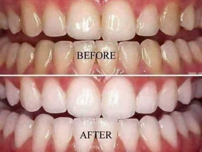 Nha Khoa Hoàng Yến (NS Thoả), ảnh 2