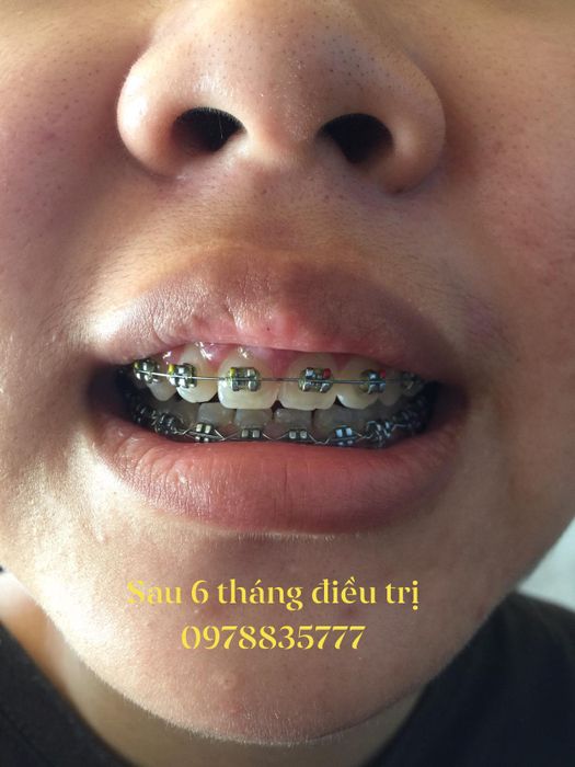 Ảnh của Nha Khoa Trung Hoà