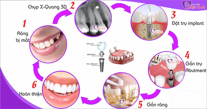 Nha khoa Việt Anh hình ảnh 2