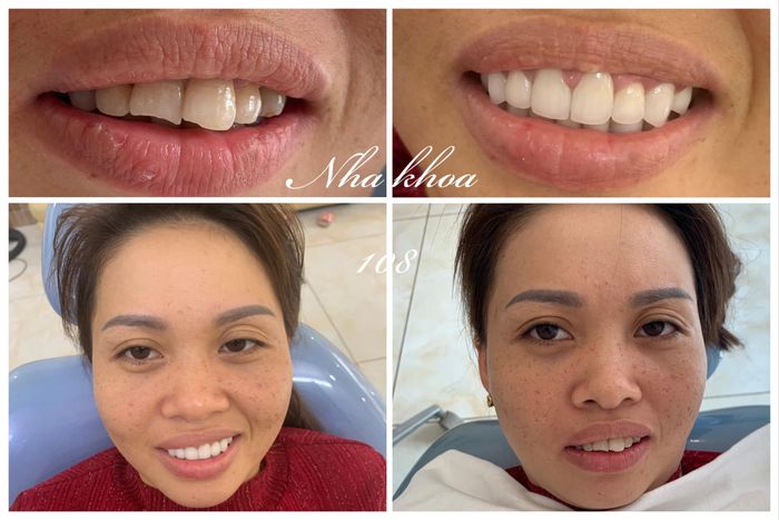 Hình ảnh Nha Khoa 108 2