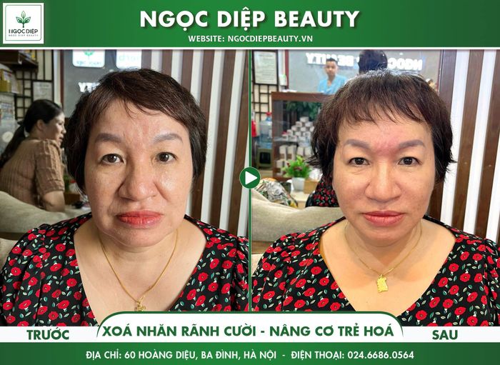 Hình ảnh Ngọc Diệp Beauty 1