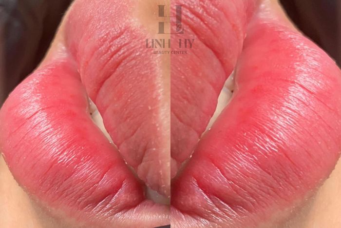 Linh Hy Beauty Center hình ảnh 2