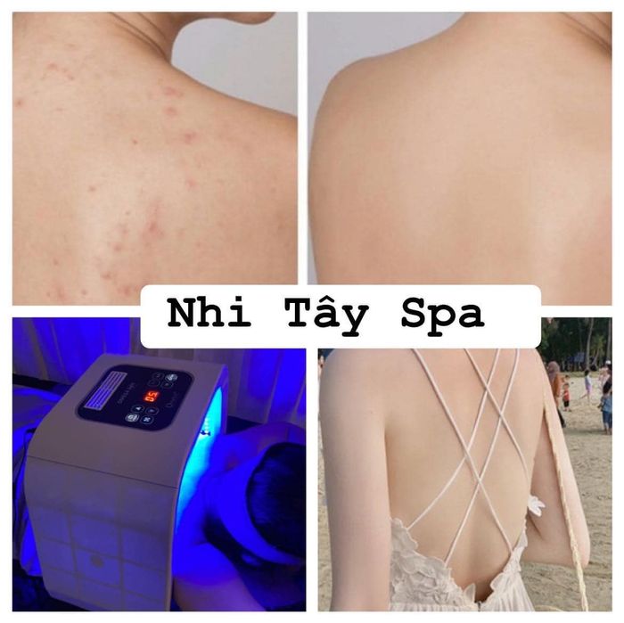 Ảnh 2 của Spa Nhi Tây Phan Thiết