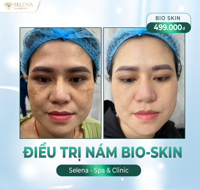 Ảnh 2 của Selena SPA Phan Thiết