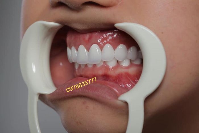 Hình ảnh Nha Khoa Trung Hoà 2