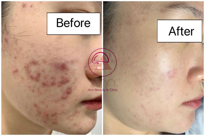 Ảnh 1 của Ann Beauty Spa & Clinic