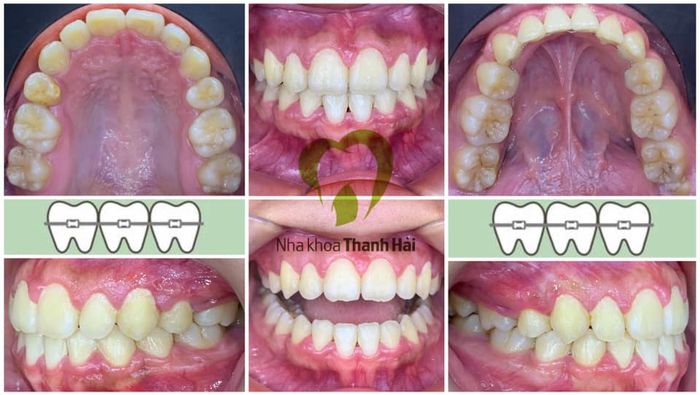 Nha khoa THANH HẢI hình 2