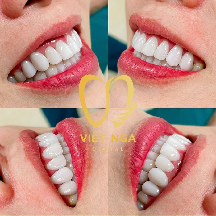 Nha khoa Việt Nga - Hình ảnh 3