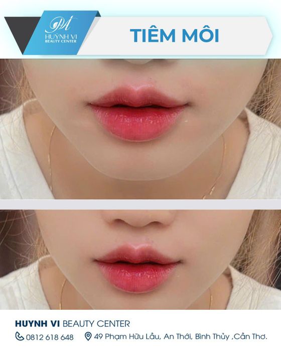 Ảnh 2 của Huỳnh Vi Beauty & Academy