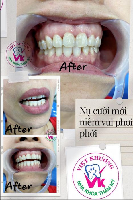 Hình ảnh 2 của Phòng khám Nha khoa Việt Khương