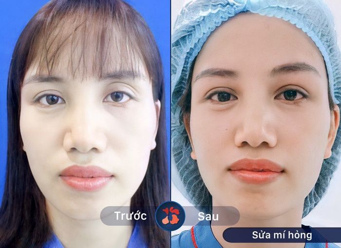 Hình ảnh Bệnh viện thẩm mỹ Kangnam 1