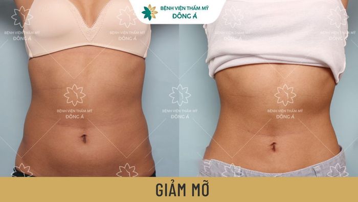 Ảnh Bệnh viện Thẩm mỹ Đông Á 1