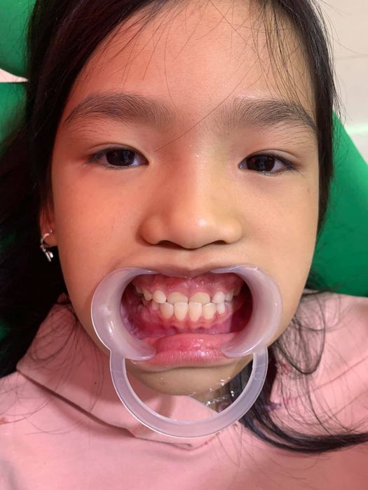 PHÒNG KHÁM RĂNG XUÂN HOÀ hình 3