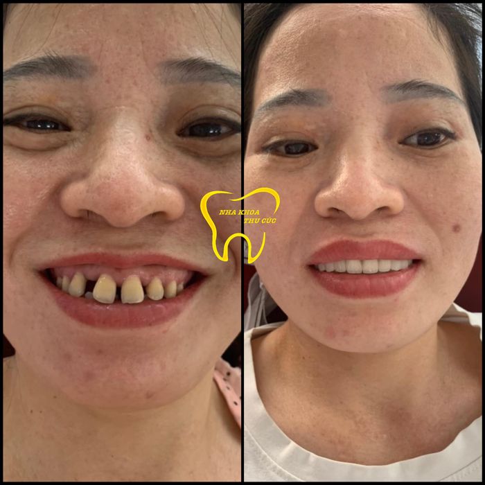 Hình ảnh Nha Khoa Thu Cúc 2
