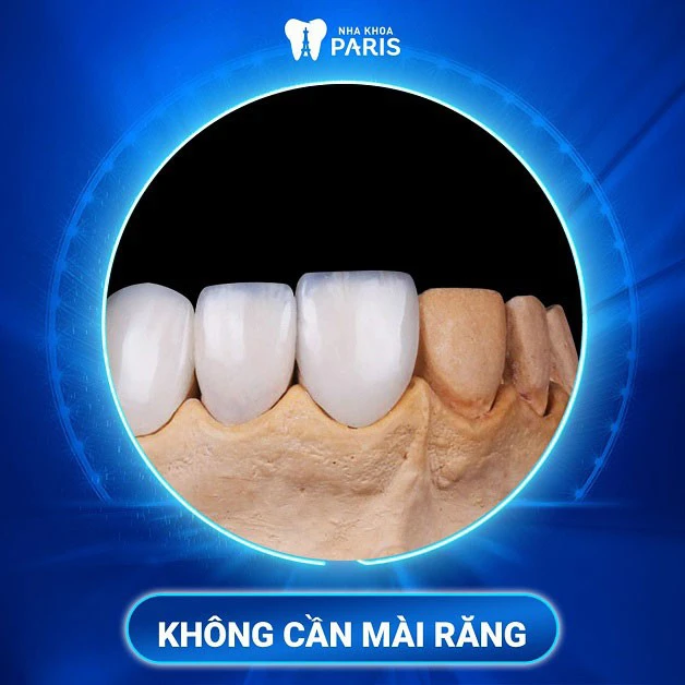 Nha khoa Paris hình 2