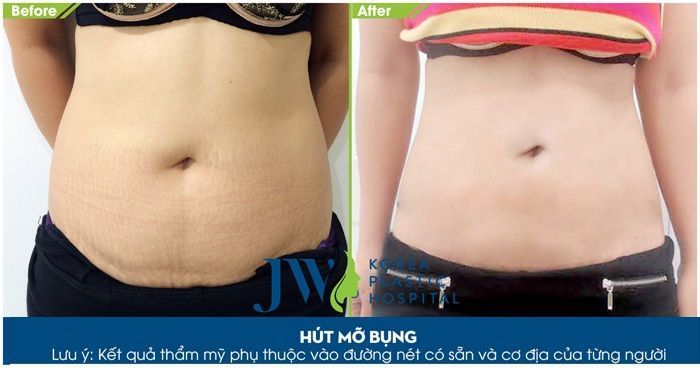 Hình ảnh Bệnh viện Thẩm Mỹ JW Hàn Quốc 2