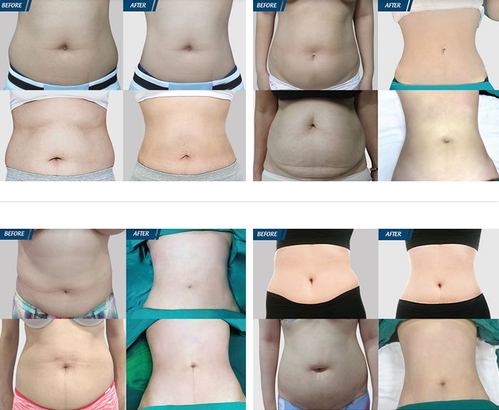 Hình ảnh Bệnh viện Thẩm Mỹ JW Hàn Quốc 1