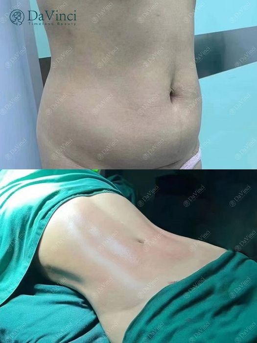 Hình ảnh Viện Thẩm Mỹ DaVinci 1