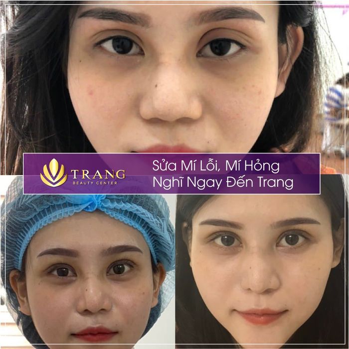 Hình ảnh Trang Beauty Center 1