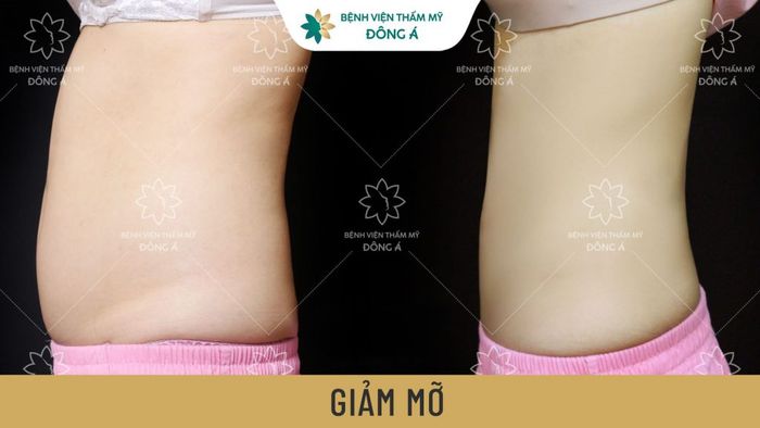 Ảnh 2 của Bệnh viện Thẩm mỹ Đông Á