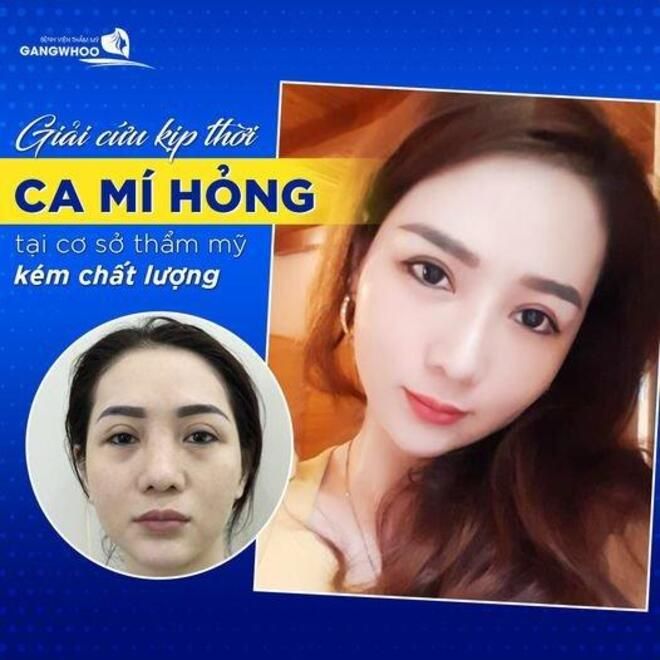 Bệnh viện thẩm mỹ Gangwhoo hình ảnh 2