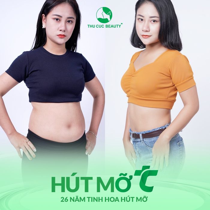 Hình ảnh Thẩm Mỹ Thu Cúc 2